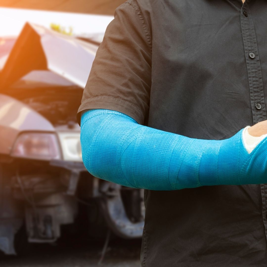 A man in a cast after a car accident.