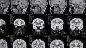 Various brain scan images