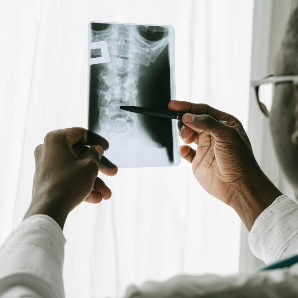 Un médico mirando una radiografía