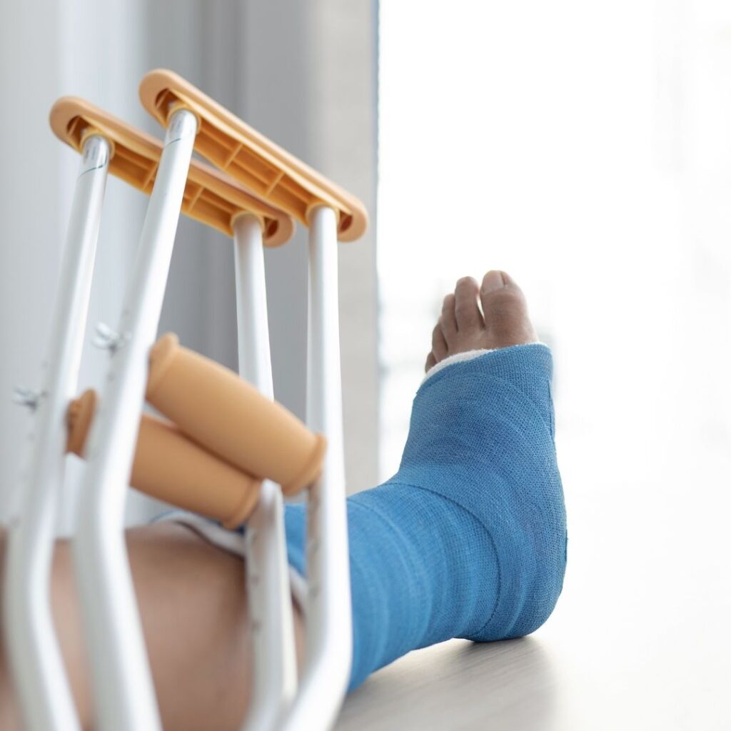broken leg with crutch