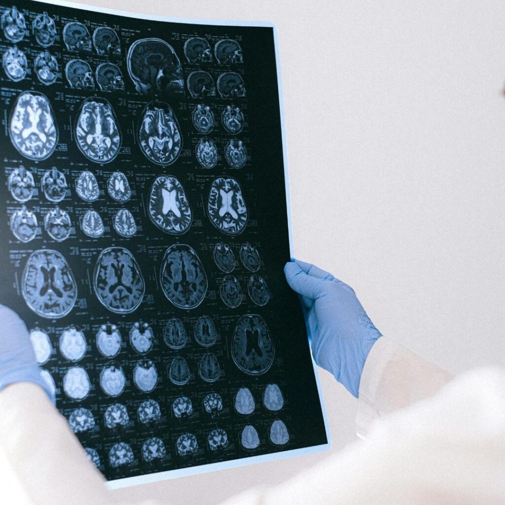 scans of brain
